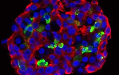 This is stem cell-derived pancreatic tissue with insulin depicted in red and glucagon in green.
